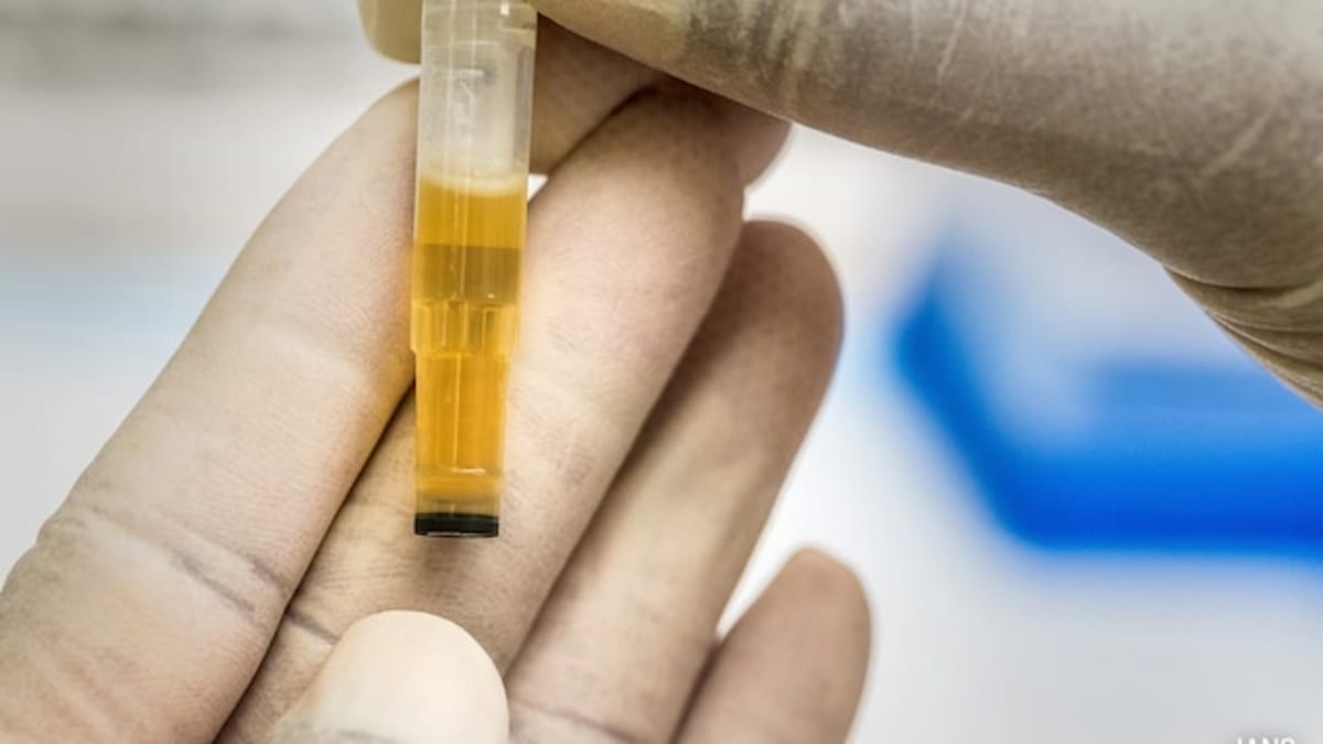 New Home Urine Test Detects 92% of Bladder Cancers - Image 2