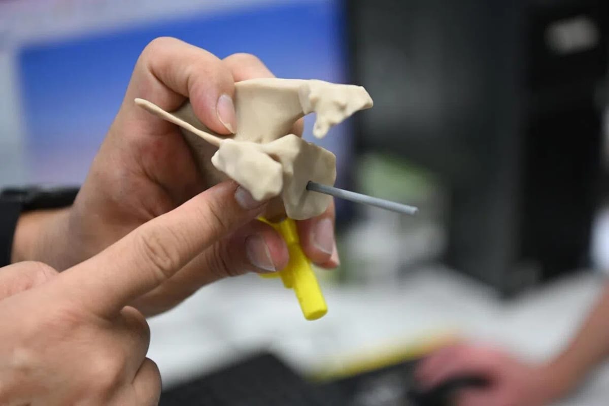 Singapore Doctors Use Airplane Tech for Shoulder Surgery - Image 3