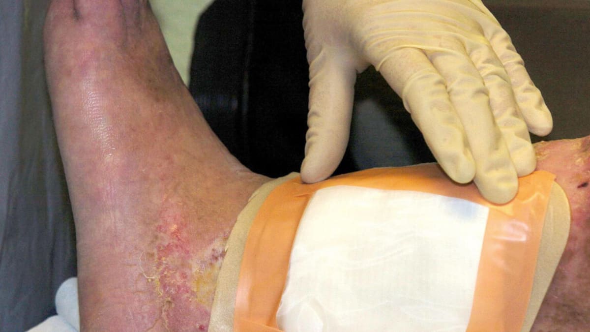 Medical professional examining wound care treatment supplies in sterile clinical setting