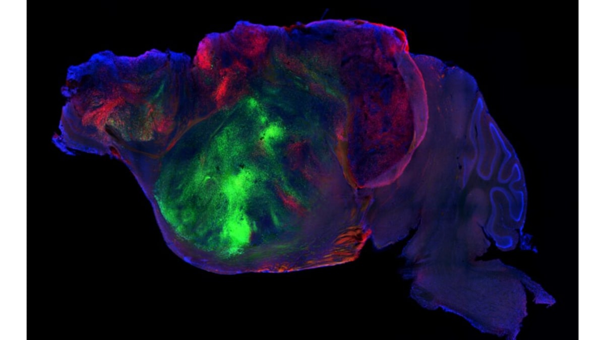 Microscopic view of human brain cells integrated into mouse brain tissue glowing under laboratory imaging