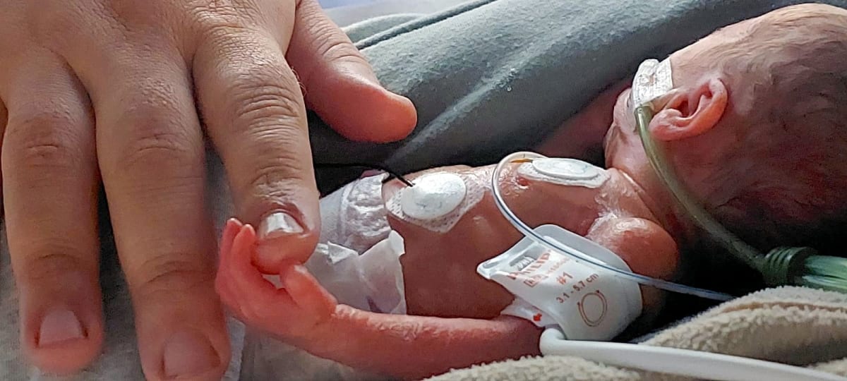 Baby Eli Survives at 740g Thanks to Blood Donors - Image 3