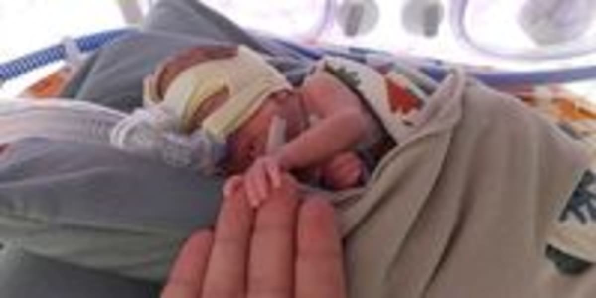 Baby Eli Survives at 740g Thanks to Blood Donors - Image 4