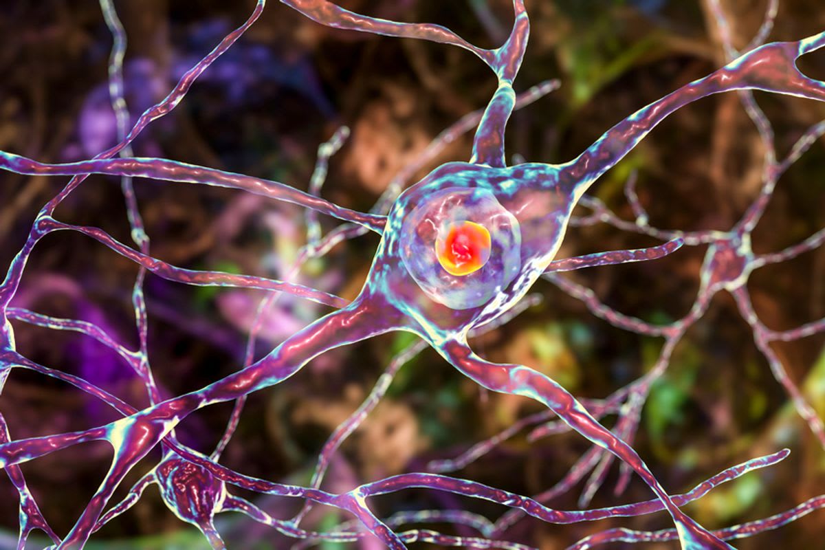 Huntington's Gene Therapy Shows 75% Slower Disease Progress