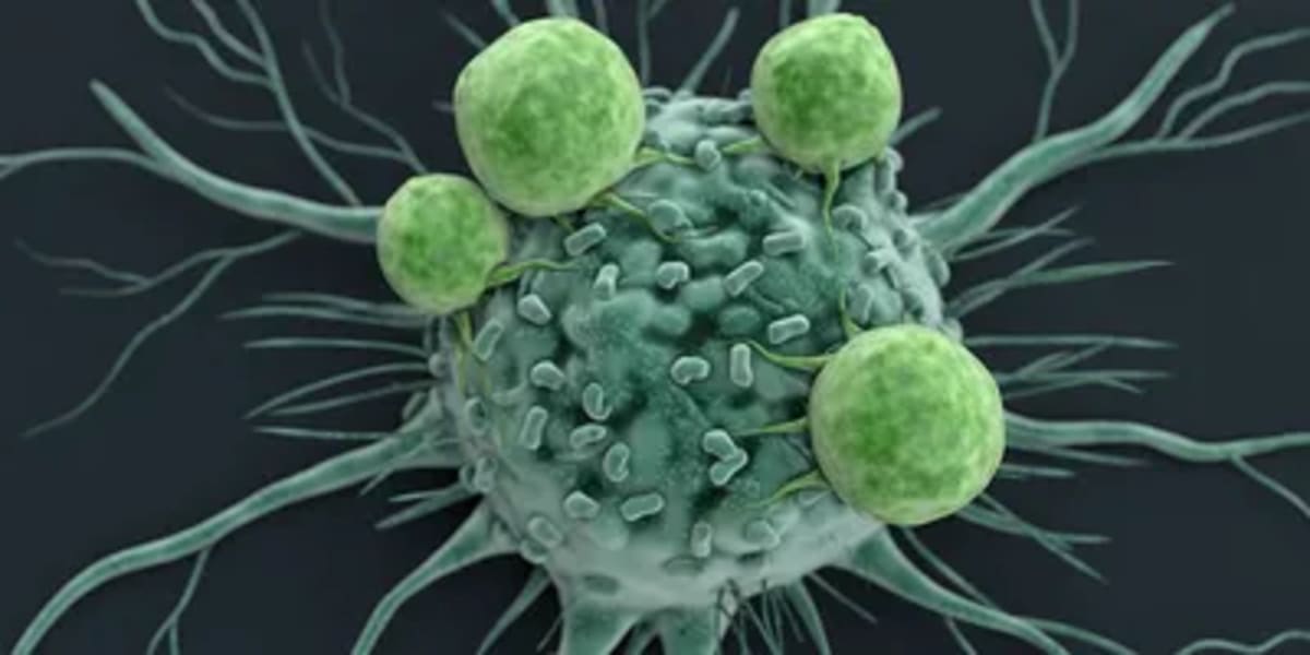 New T Cell Therapy Keeps 3 Kids Cancer-Free for Years - Image 3