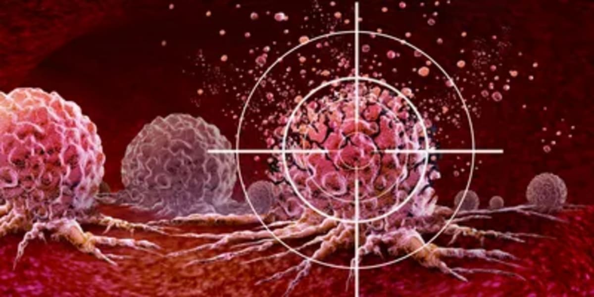New T Cell Therapy Keeps 3 Kids Cancer-Free for Years - Image 2