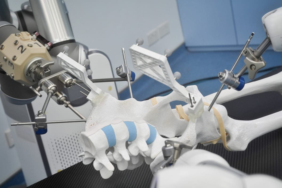 Hong Kong Debuts Robot Surgery That Saves Lives - Image 4