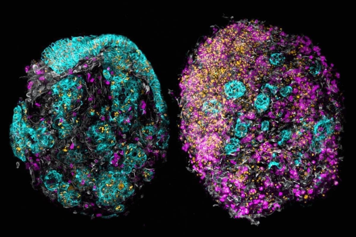 Blood Test Solves Cancer's Hardest Mystery in Days - Image 2