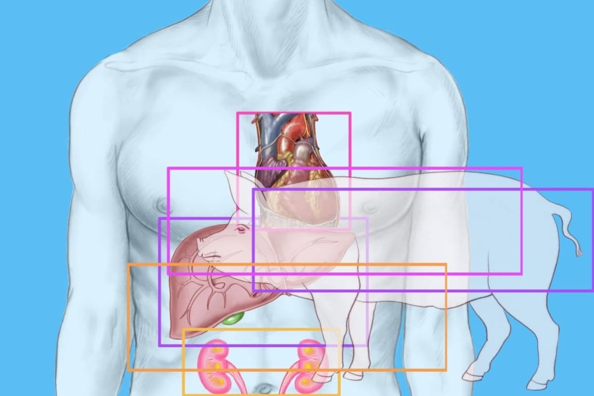 China Completes First Pig Liver and Kidney Transplant - Image 2