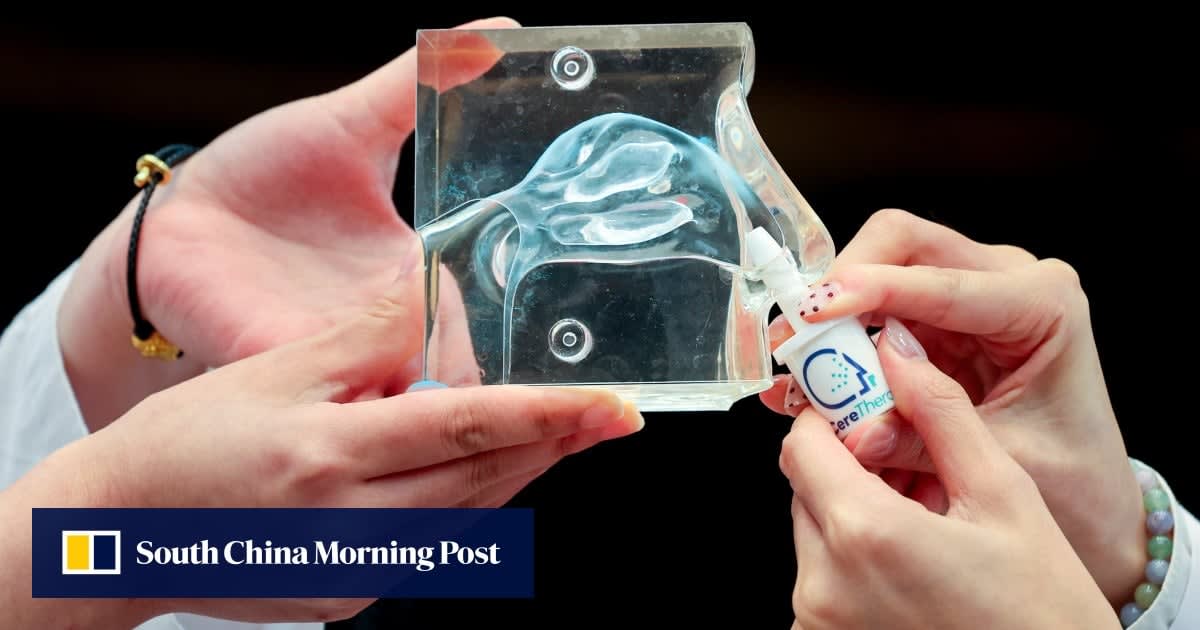 Hong Kong Nasal Spray Cuts Stroke Brain Damage by 80%