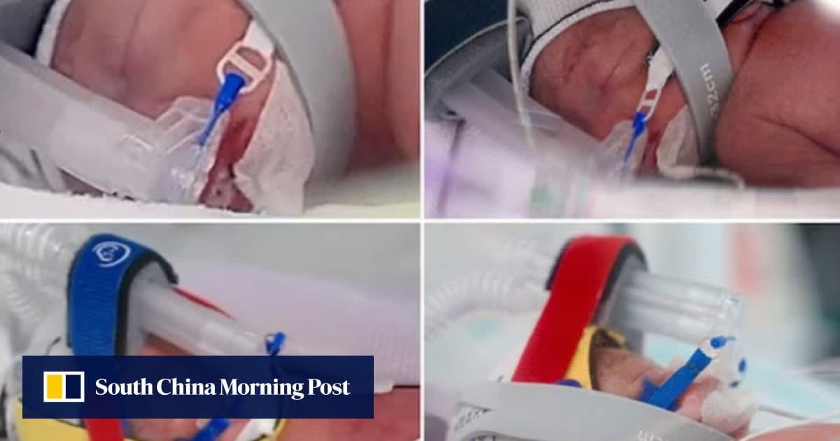 Four newborn identical quadruplet baby girls swaddled together in hospital blankets at Queensland hospital