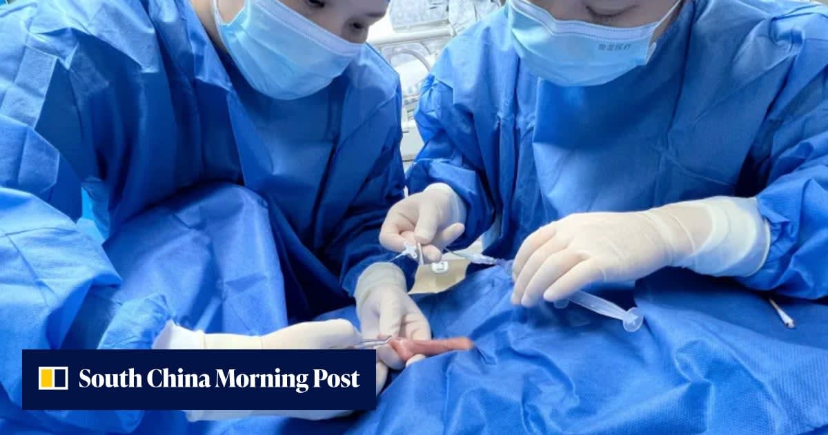 Tiny premature newborn baby receiving specialized medical care in neonatal intensive care unit