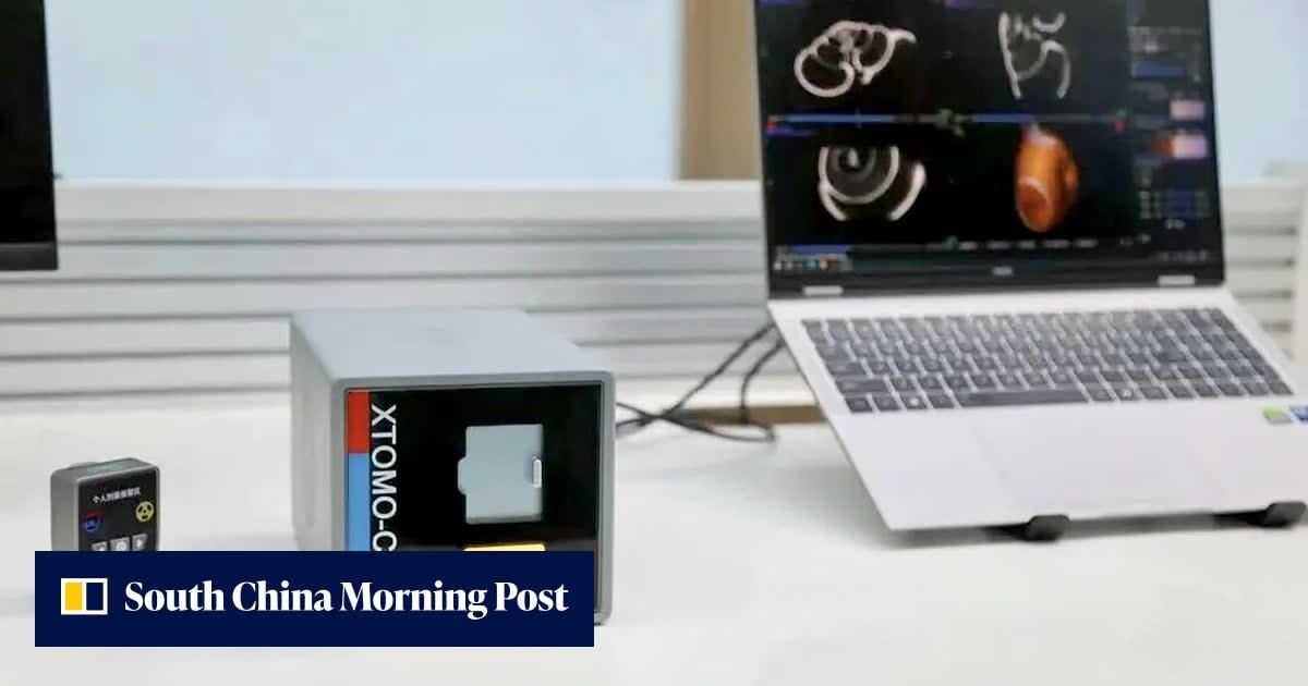 Scientists Build 6kg CT Scanner Small Enough to Hold