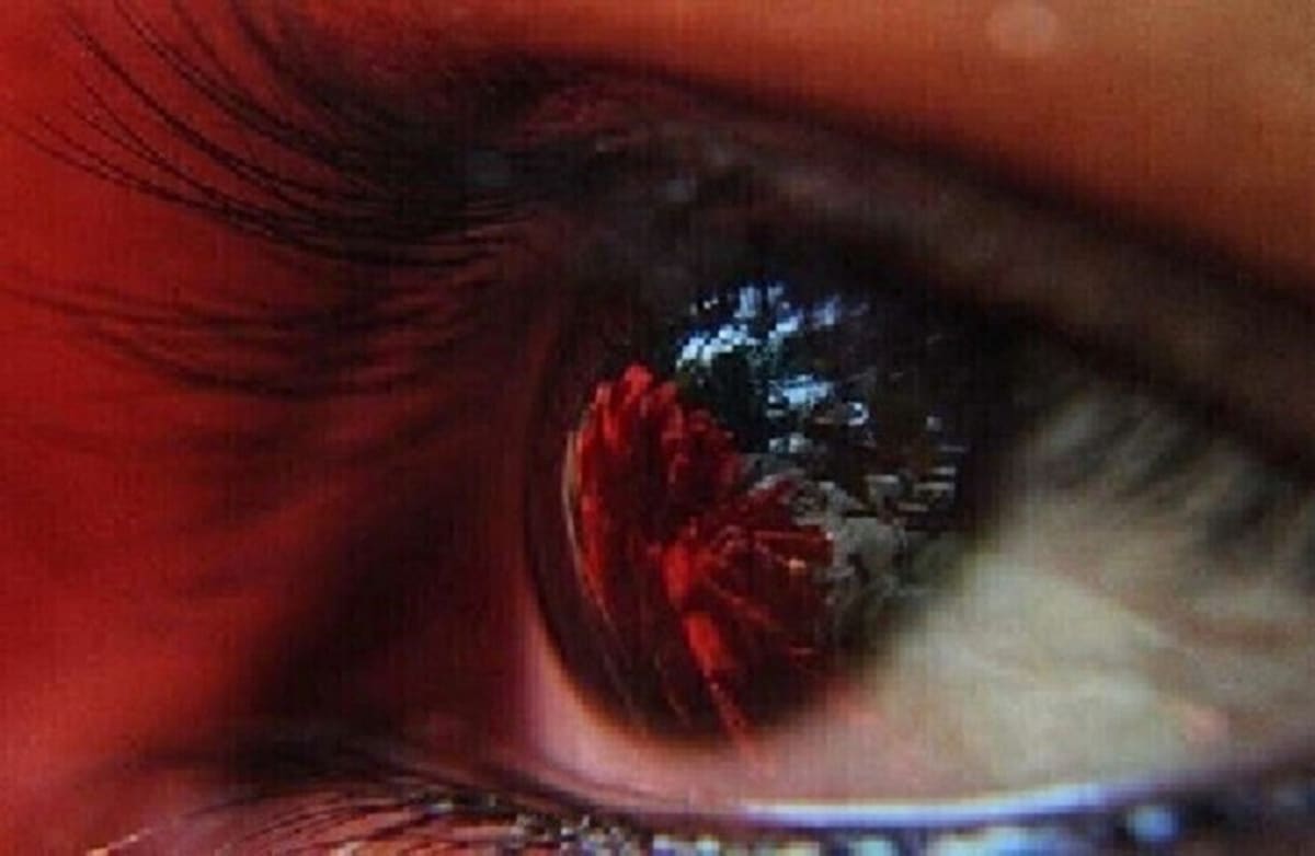 Eye Surgery Restores Light Response in Blind Patient