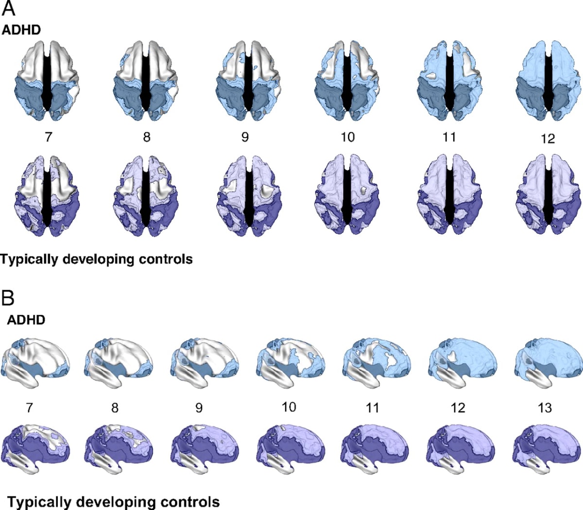 Major ADHD Brain Study Gets a Do-Over With Better Results - Image 3