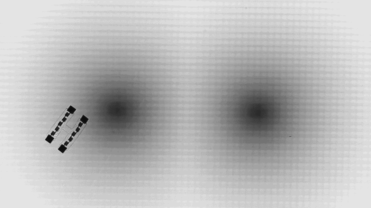 New Drug Cuts Seizures 91% in Kids With Rare Epilepsy - Image 5