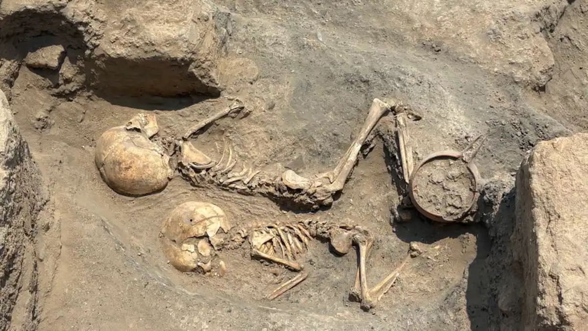 4,000-Year-Old Child Surgery Found in Central Asia - Image 2
