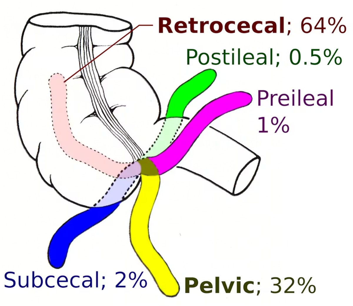 Your Appendix Evolved 32 Times—It's Not Useless After All - Image 3