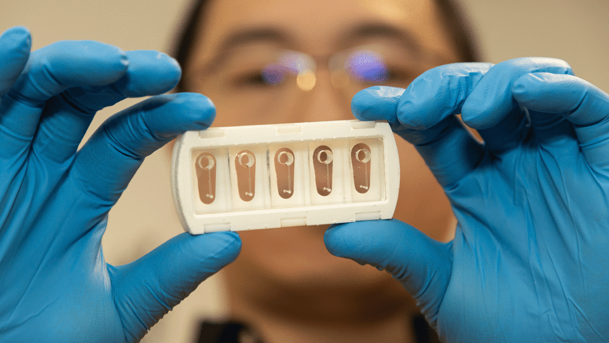 Scientists Create Tiny Arteries to Predict Stroke Risk - Image 2