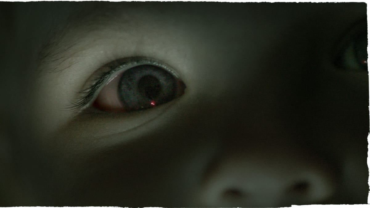 Eye Drops Could Replace Painful Injections for Kids' Cancer - Image 2