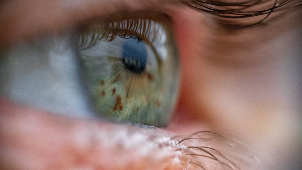 New Eye Test Detects Anemia Without Needles in 10 Seconds - Image 2