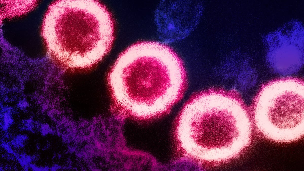 Flu Drugs May Reverse Cognitive Decline in HIV Patients - Image 3