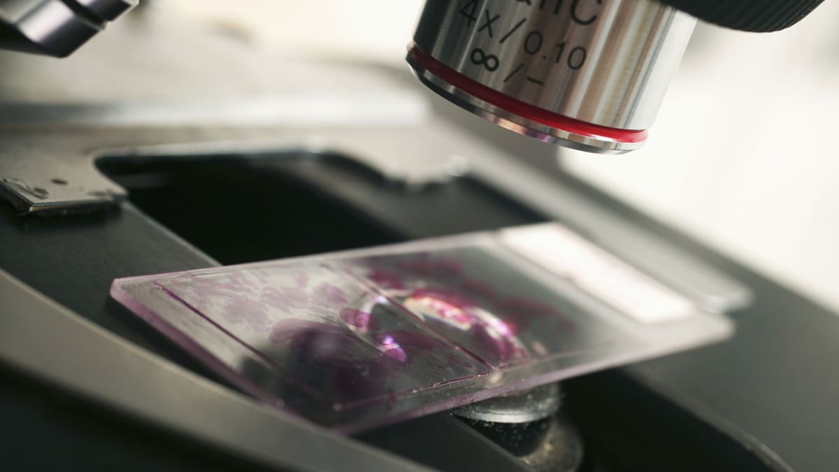 AI Learns to Spot Cancer by Mimicking Human Pathologists - Image 3