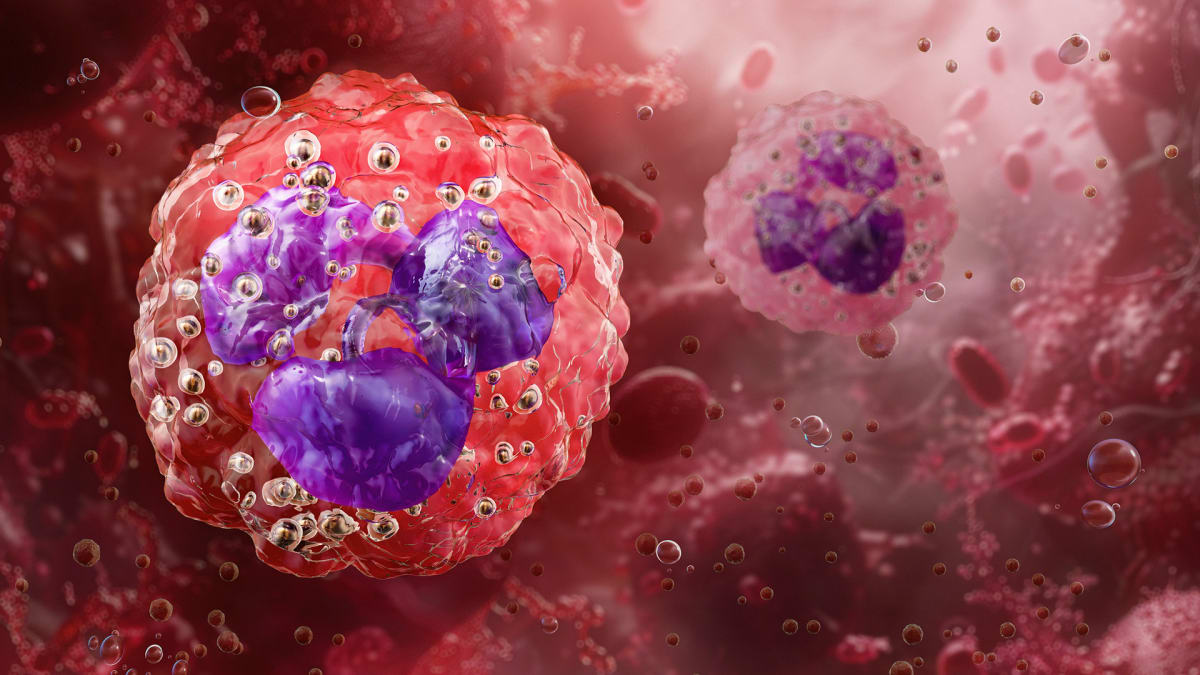 Asthma Drug May Unlock Cancer Treatment for Thousands - Image 3