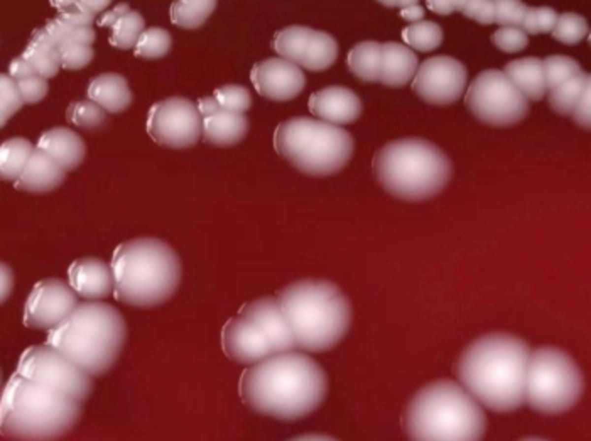 First Lyme Disease Vaccine Shows 70% Efficacy in Trials - Image 4