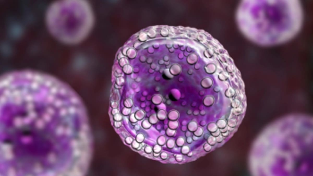 Prostate Cancer Patients Get Same Results in Fewer Visits - Image 2
