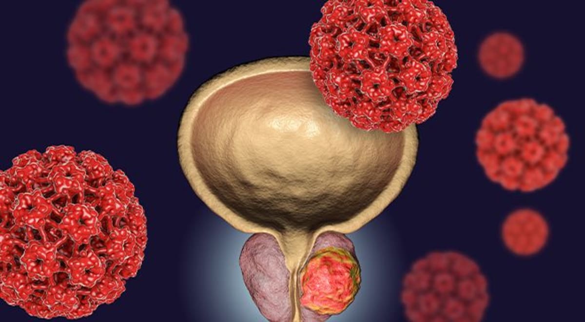** Medical researchers working with CAR T-cell therapy equipment in modern cancer treatment laboratory