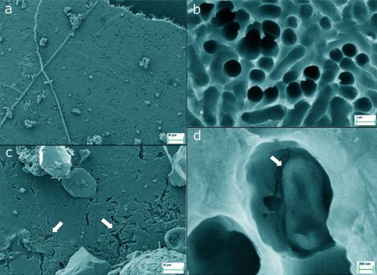 Microscope images showing biodegradable plastic film with bacterial degradation cavities after forest soil burial