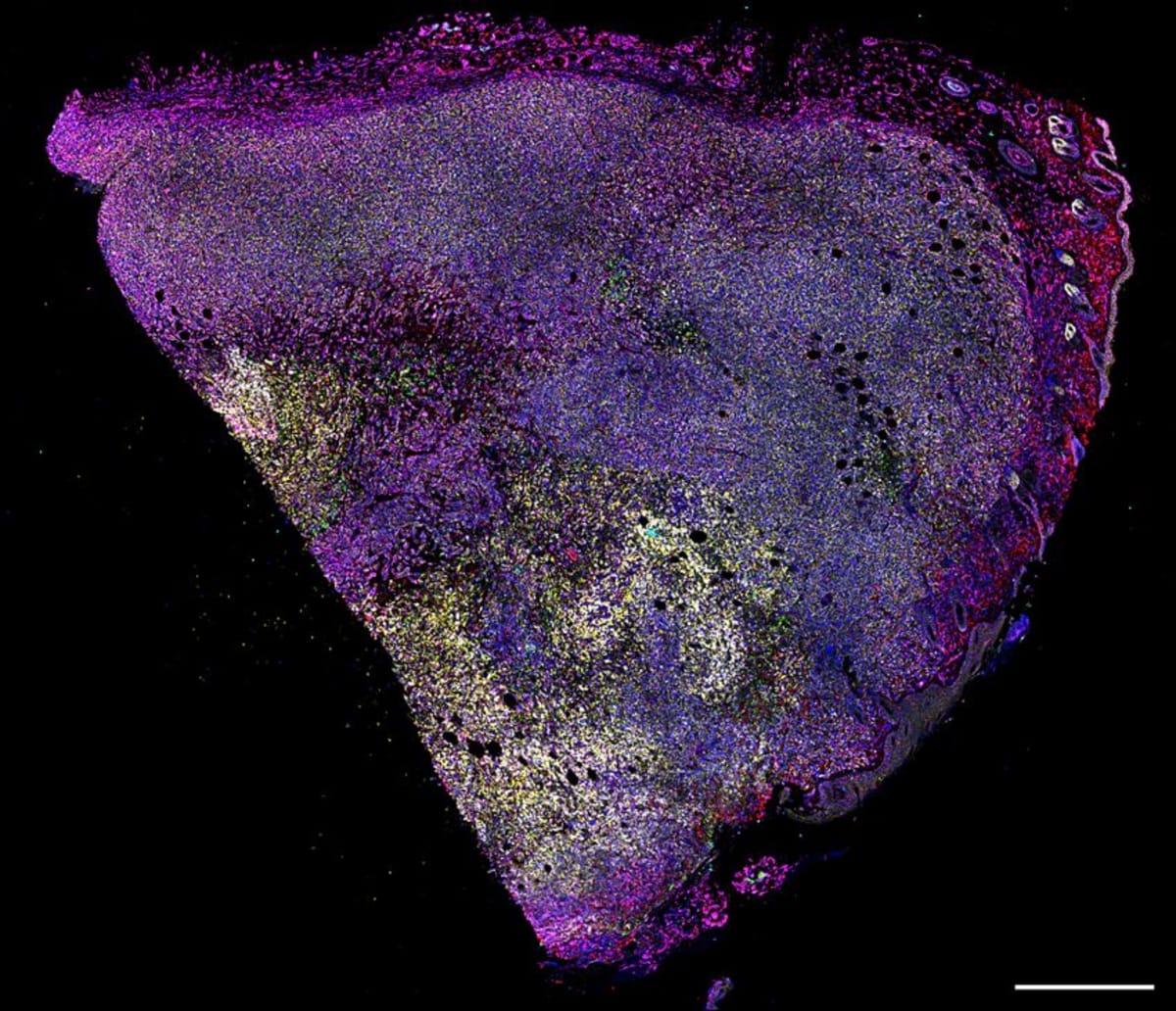Scientist's Cancer Discovery Began with a 3-Year Failure - Image 5