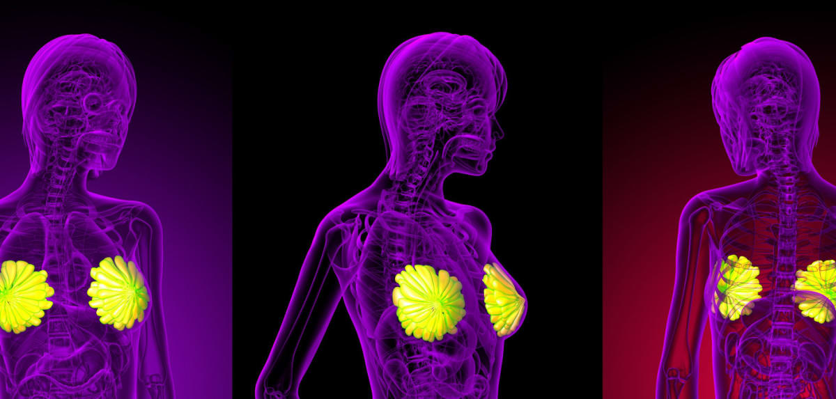 FDA Approves 5 New Breast Cancer Treatments in 2026