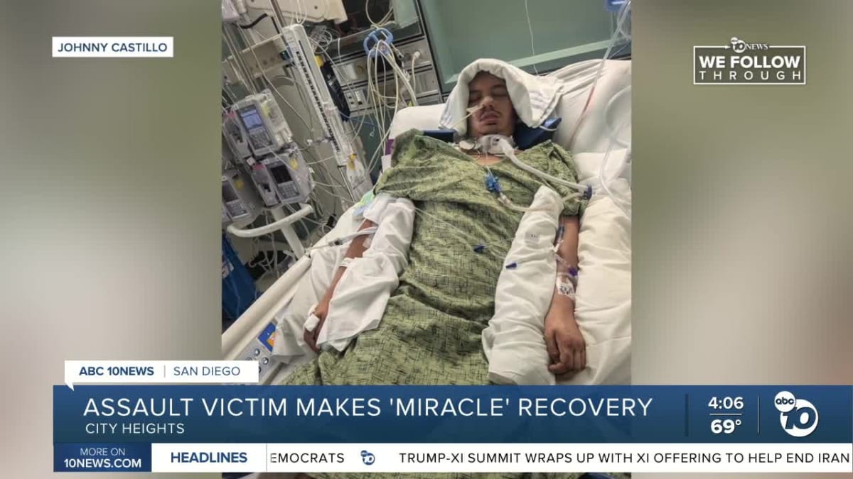 San Diego Man Defies Brain Damage Prognosis with Recovery - Image 3