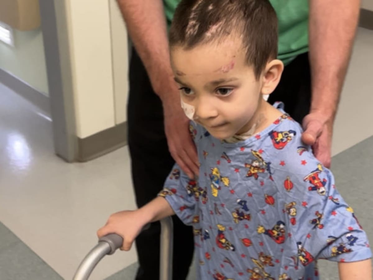 4-Year-Old Defies Odds After 50mph Crash, Brain Surgeries - Image 5