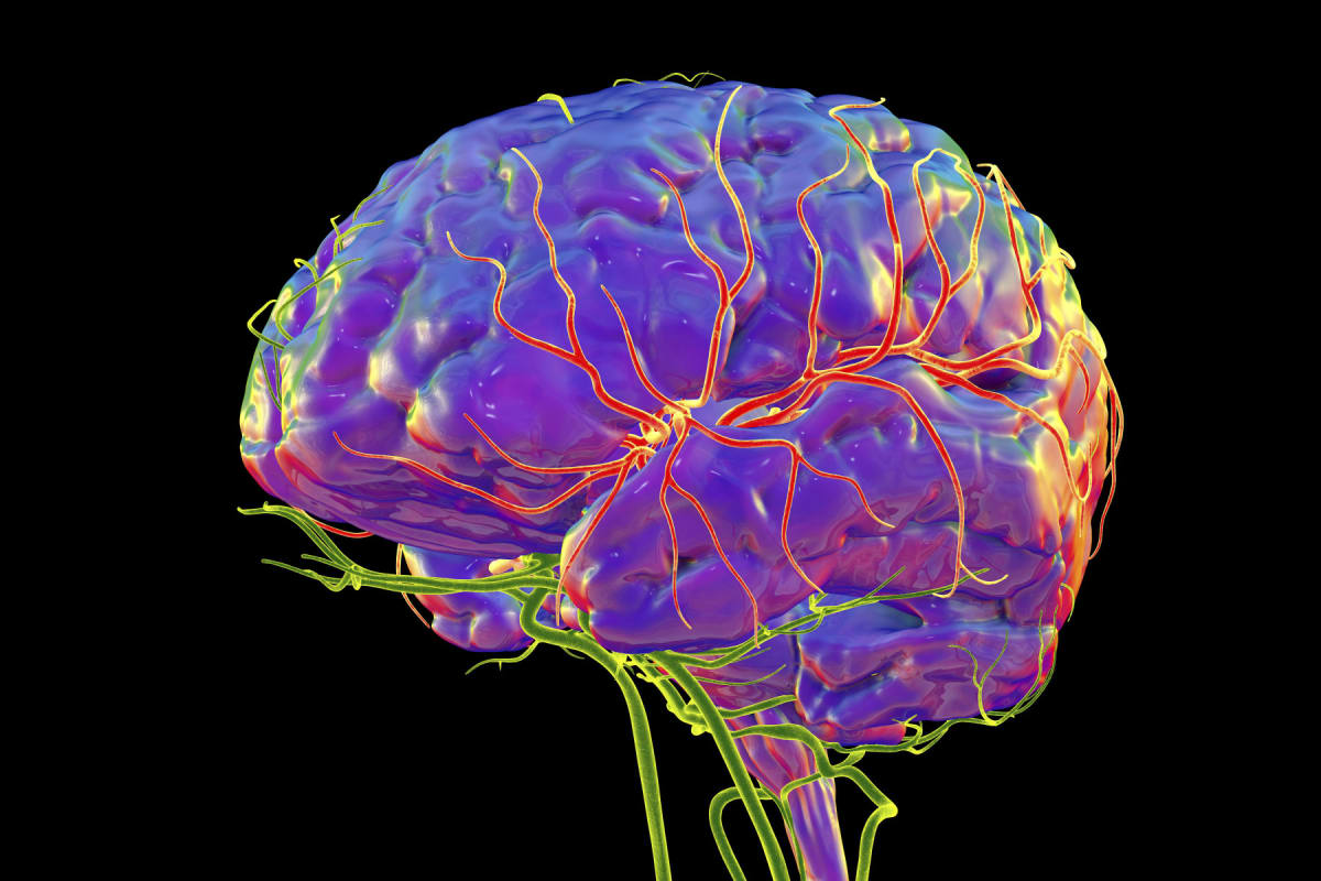 New Stroke Guidelines Expand Treatment for Kids and Adults