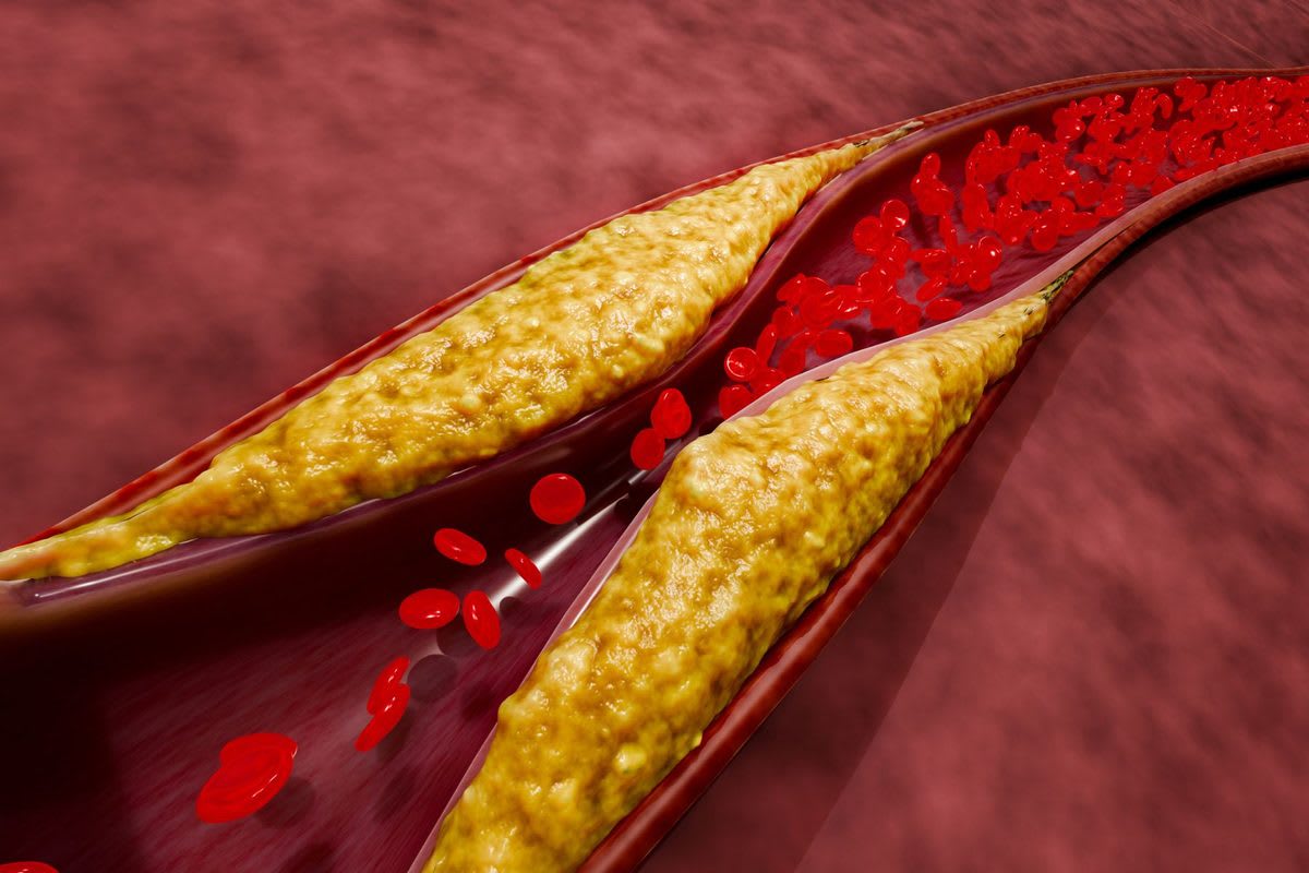Medical researcher examining vial of experimental gene therapy treatment for cholesterol reduction