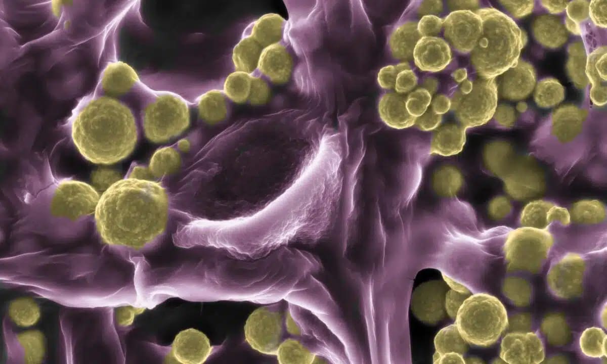 Common Fungus Eats Gold, May Revolutionize Mining - Image 3