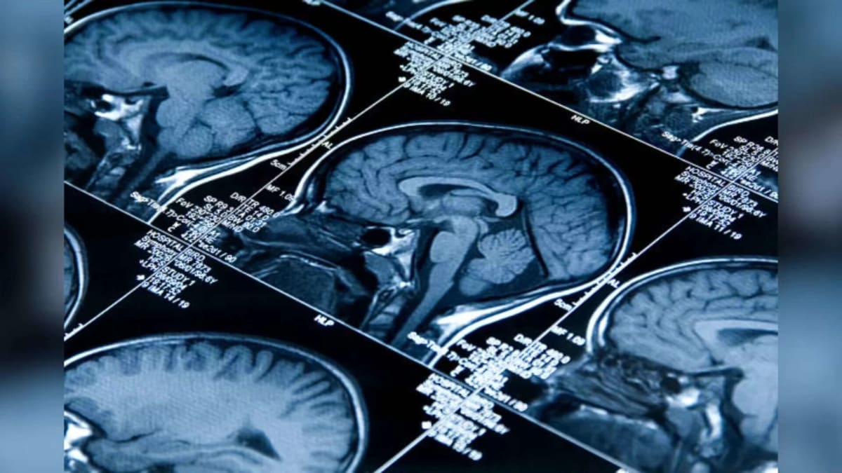 AI Maps Brain Aging to Boost Cognitive Health - Image 2