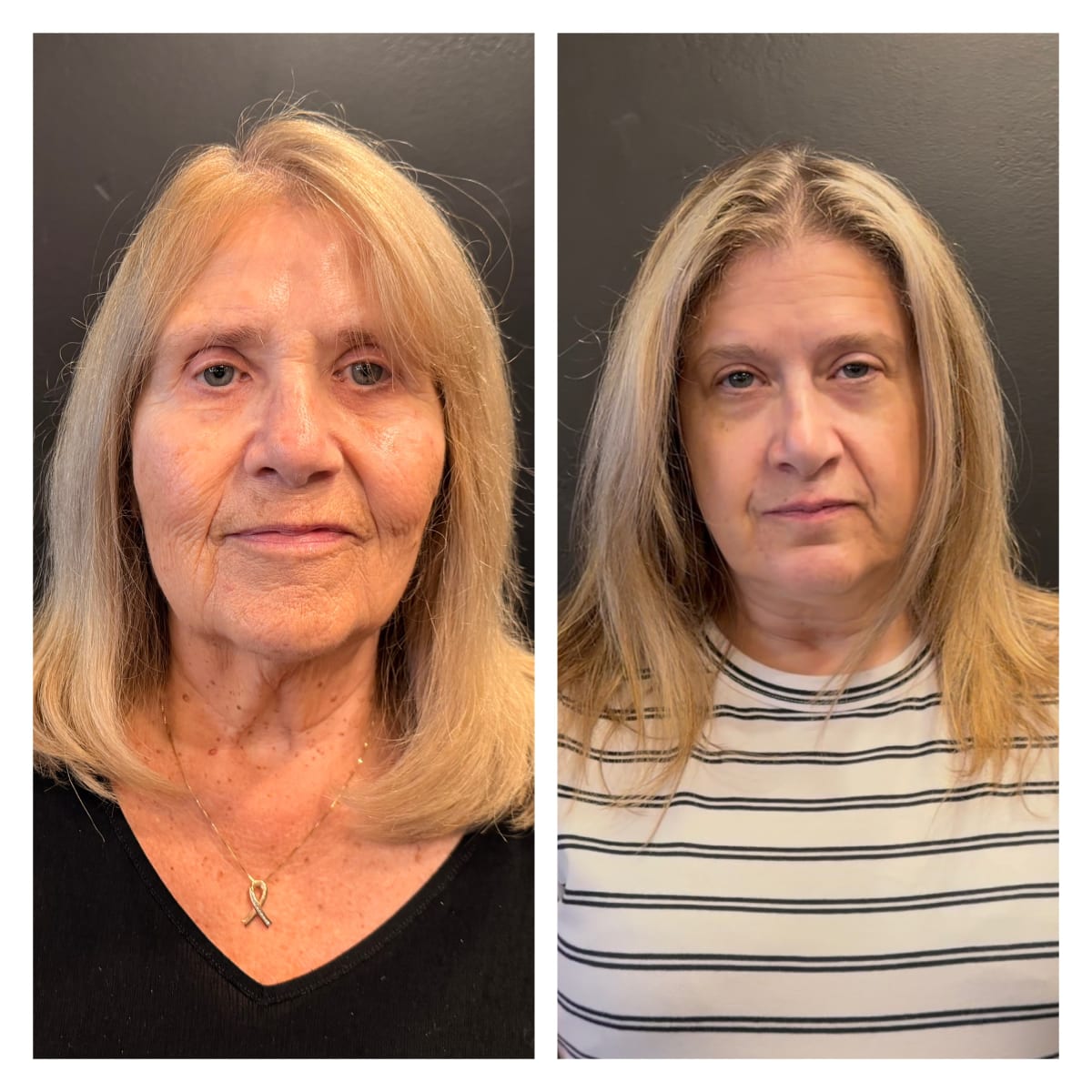 Appleton Stylists Give Cancer Survivor Morning Makeover - Image 5