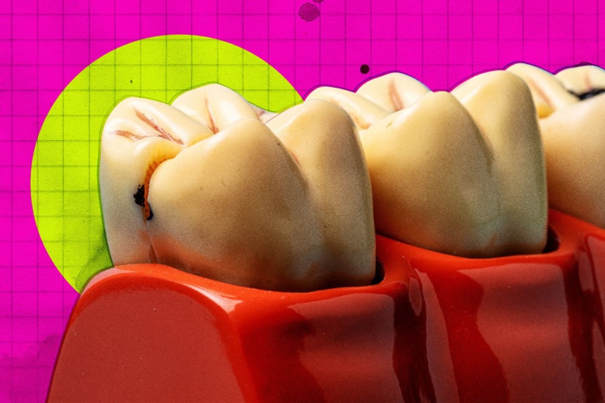 Japanese Drug Could Regrow Teeth by 2030 - Image 2
