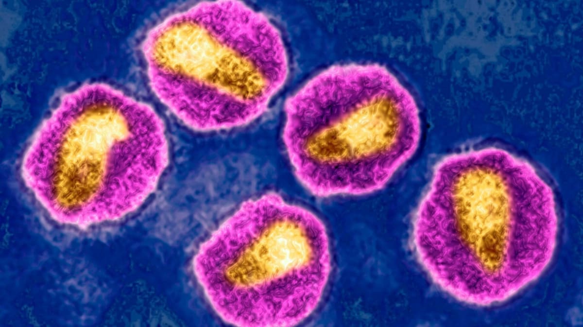 Norwegian Man Cured of HIV by Brother's Stem Cells