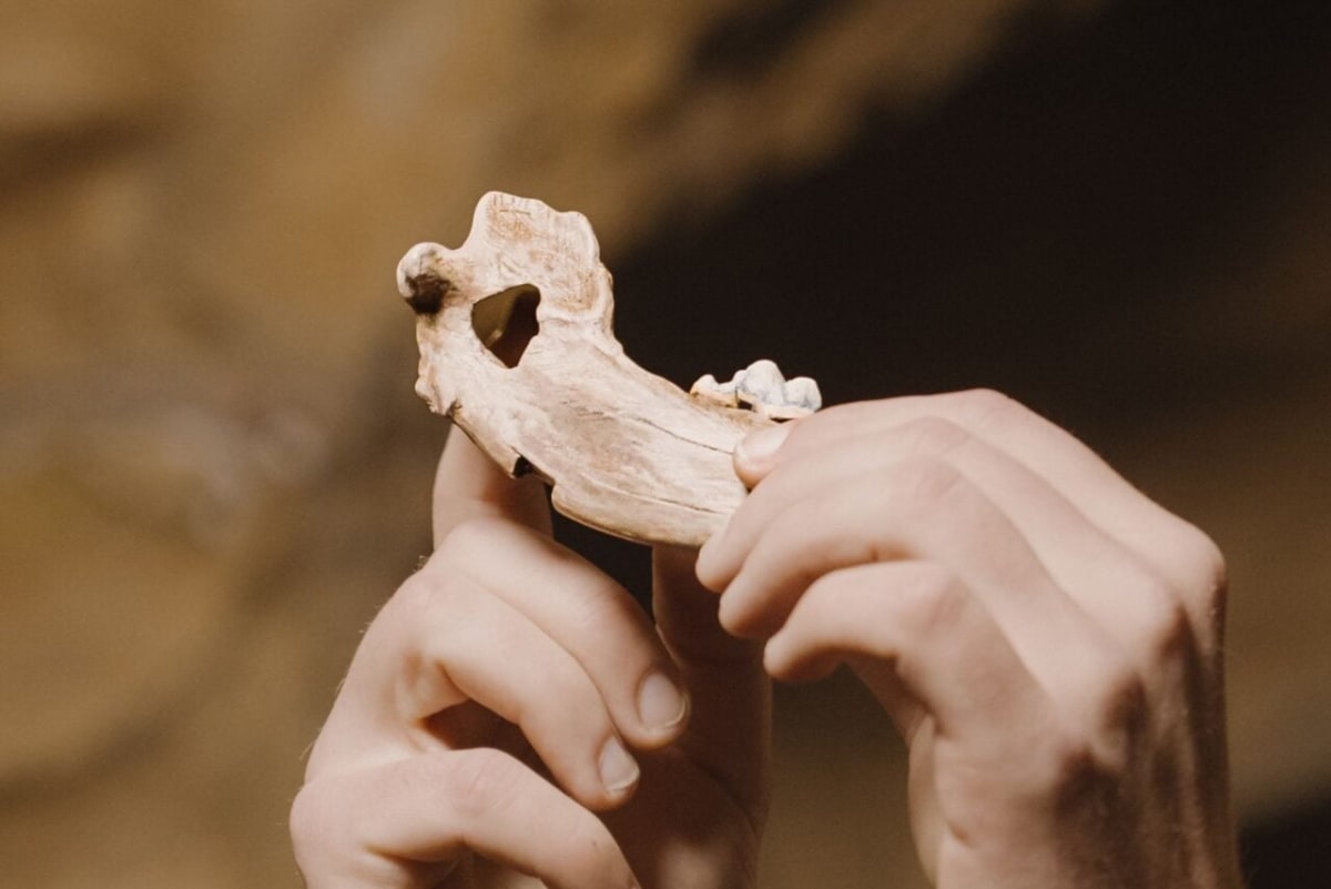 Scientists Silence Extra Chromosome in Down Syndrome Cells - Image 4