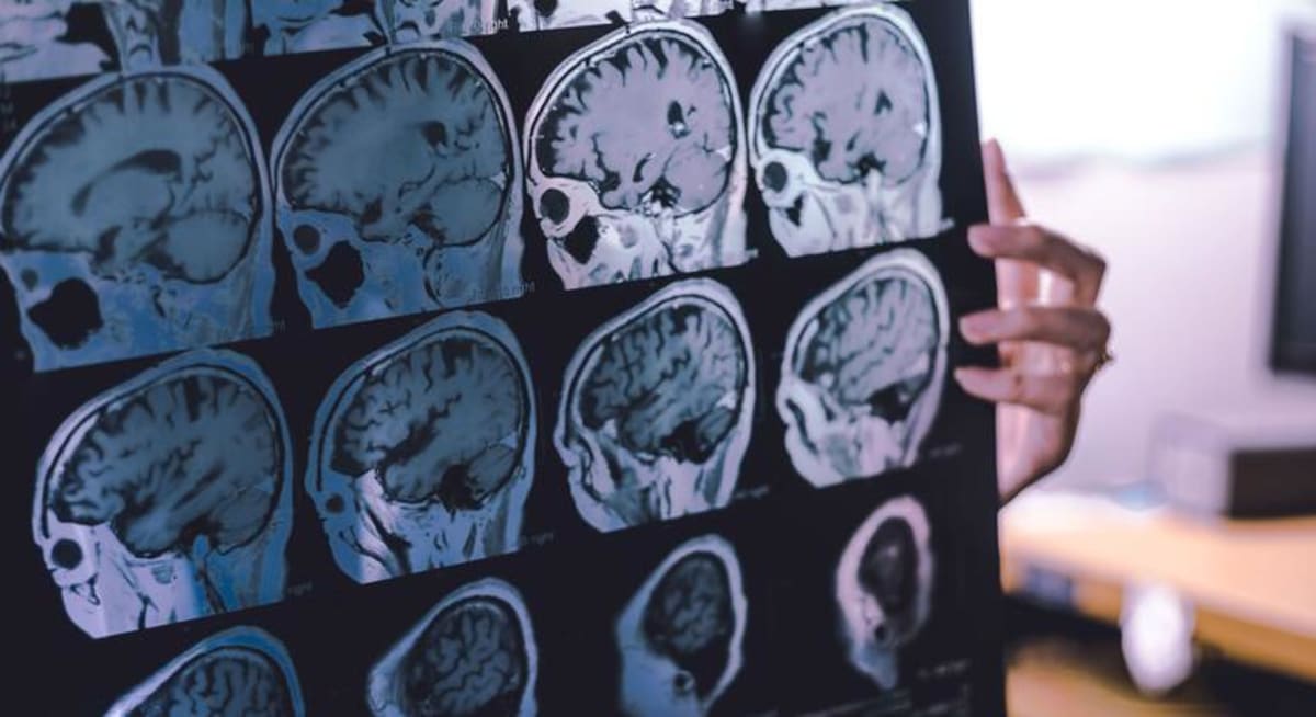 Elderly person engaging in healthy activities with family members showing brain health prevention
