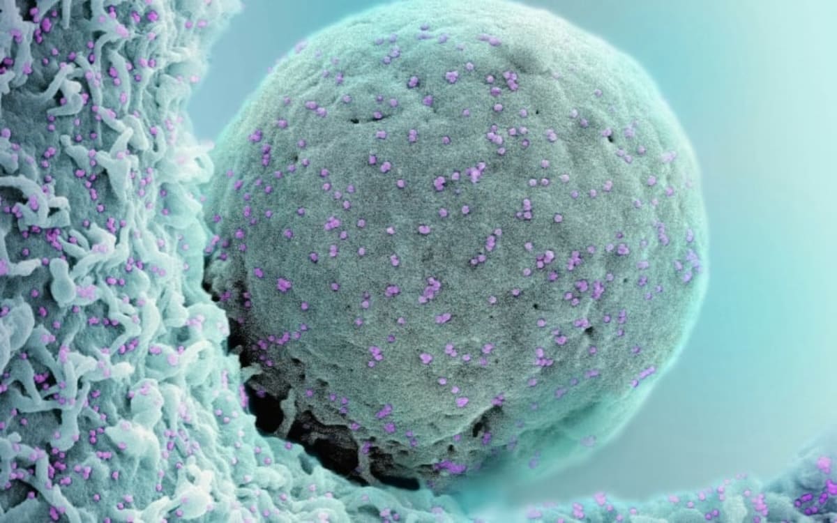 Two-Drug Combo Slows Aggressive Prostate Cancer in Mice