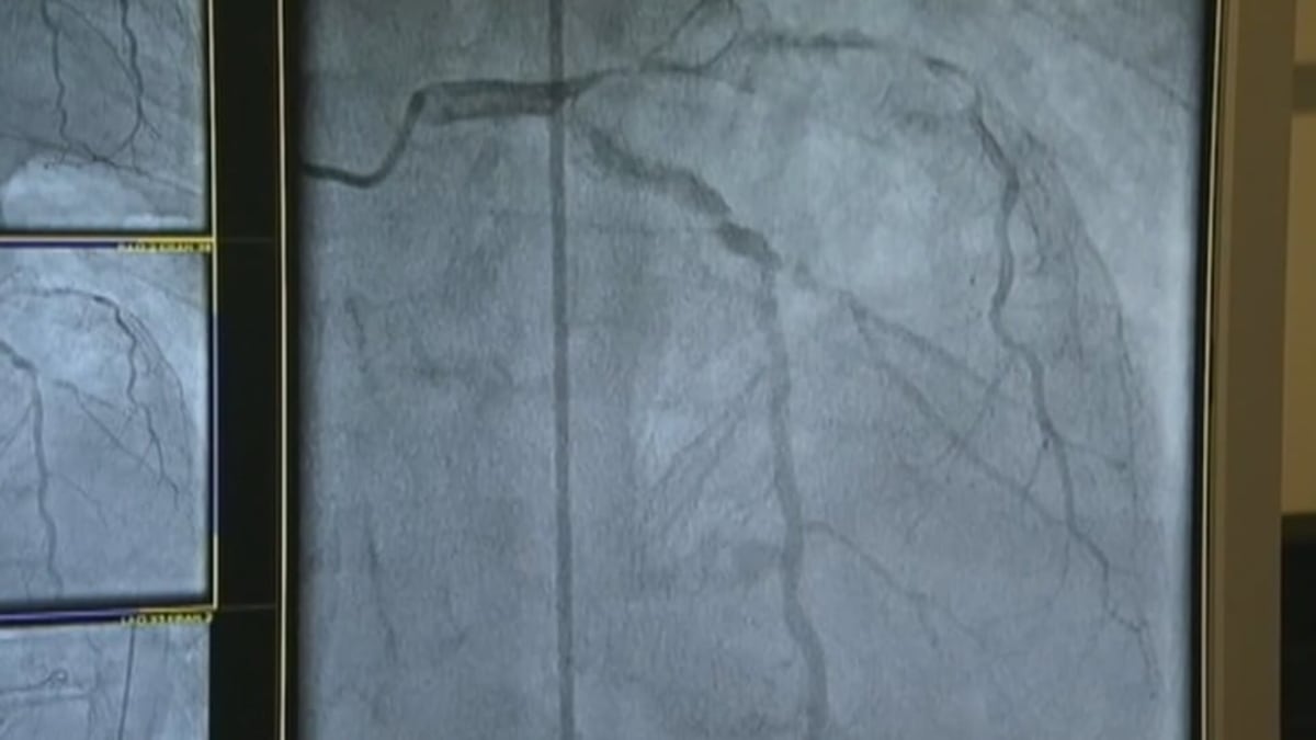 University of Arizona Turns Research Into $3.3B in New Companies - Image 3