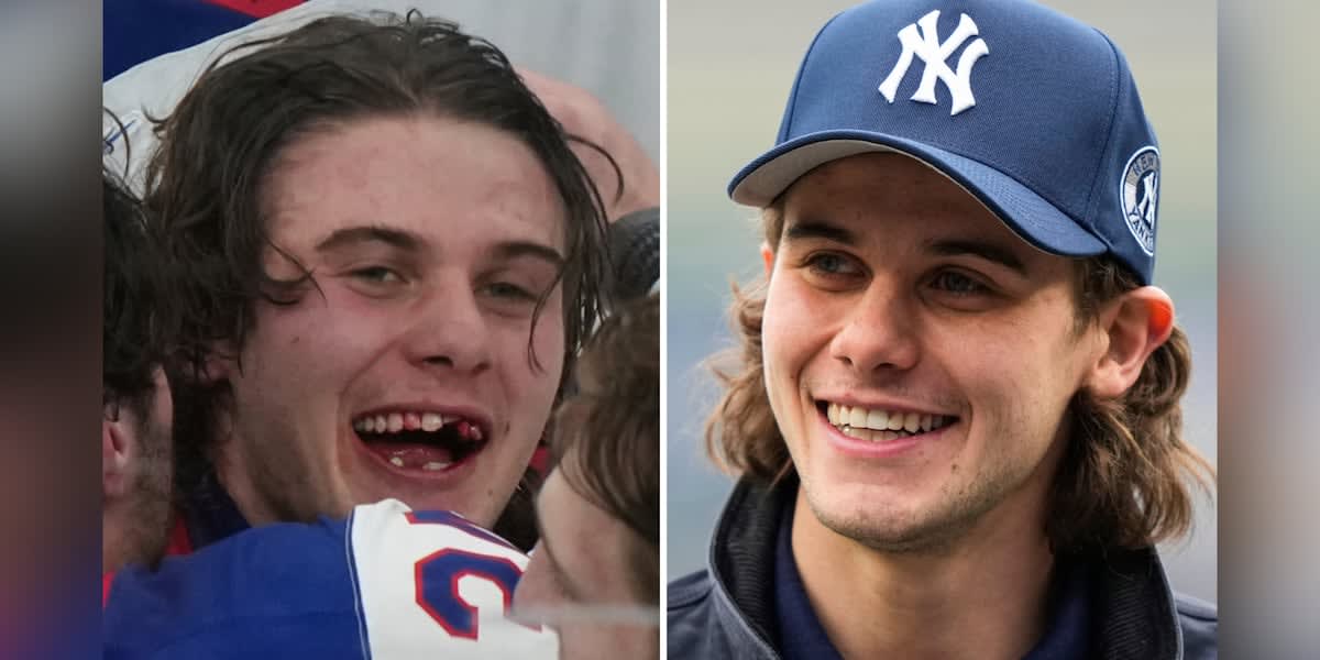 Olympic Hero Scores Gold Goal With Missing Teeth