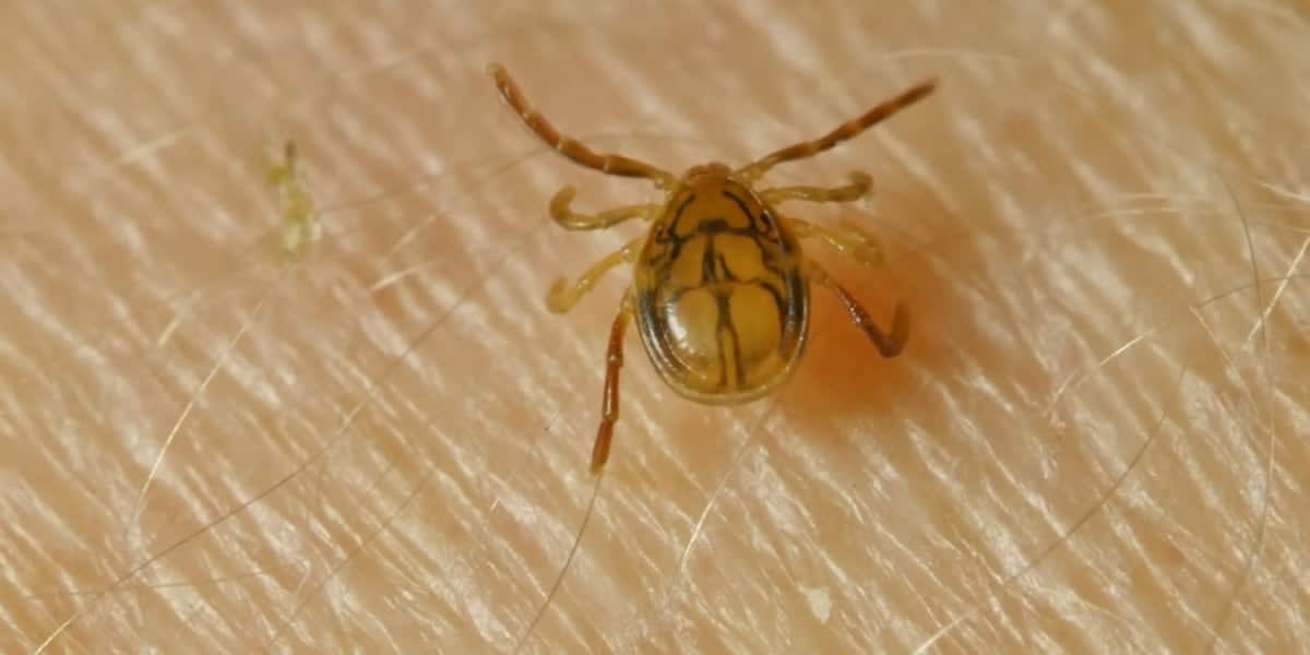 University of Kentucky medical researcher examining samples in laboratory for Lyme disease treatment development