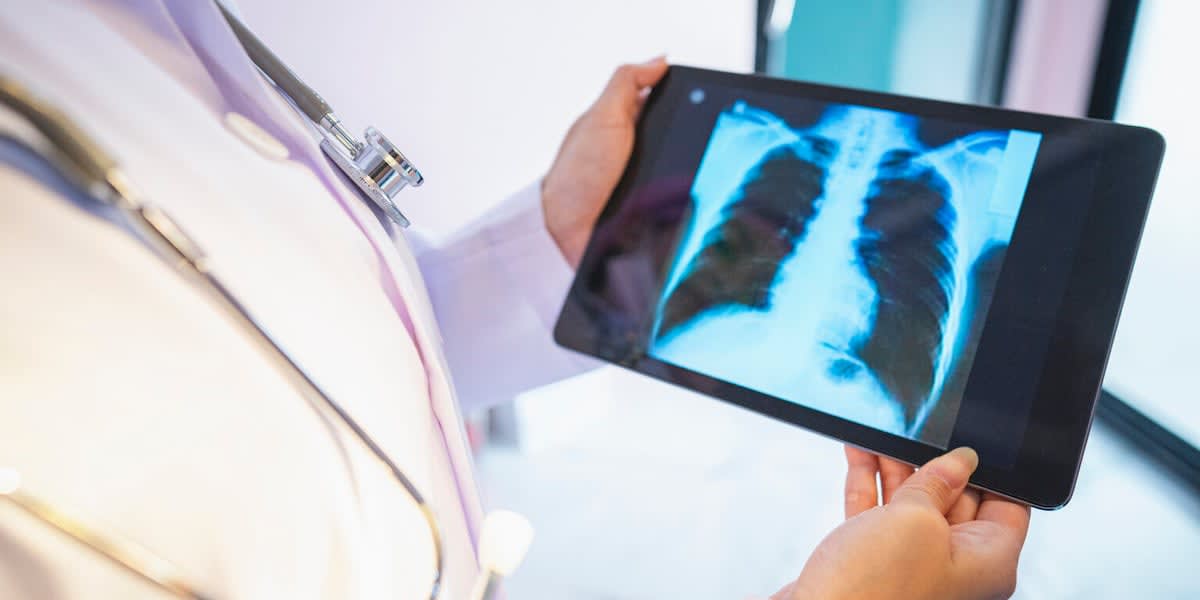 MSU Breakthrough May Help Kids With Rare Lung Disease