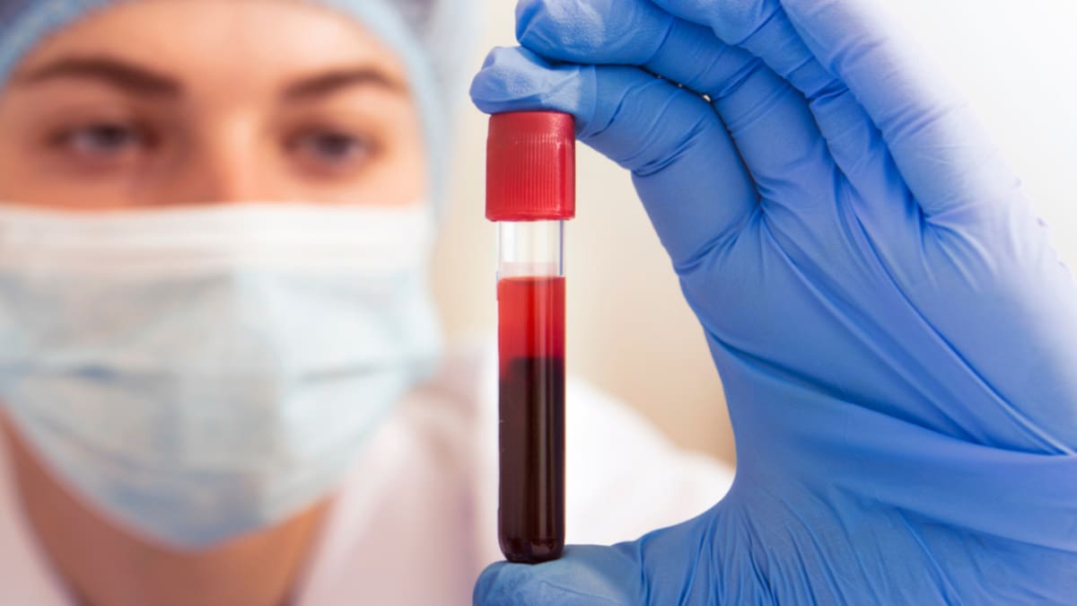 Australia Approves 90% Accurate Blood Test for Alzheimer's
